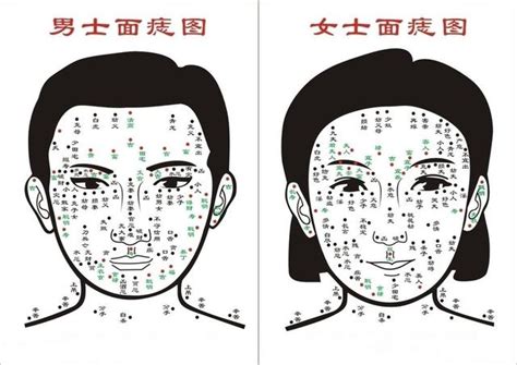 臉上紅痣面相|【2025 最新】7 種常見臉上的痣與在面相學裡的